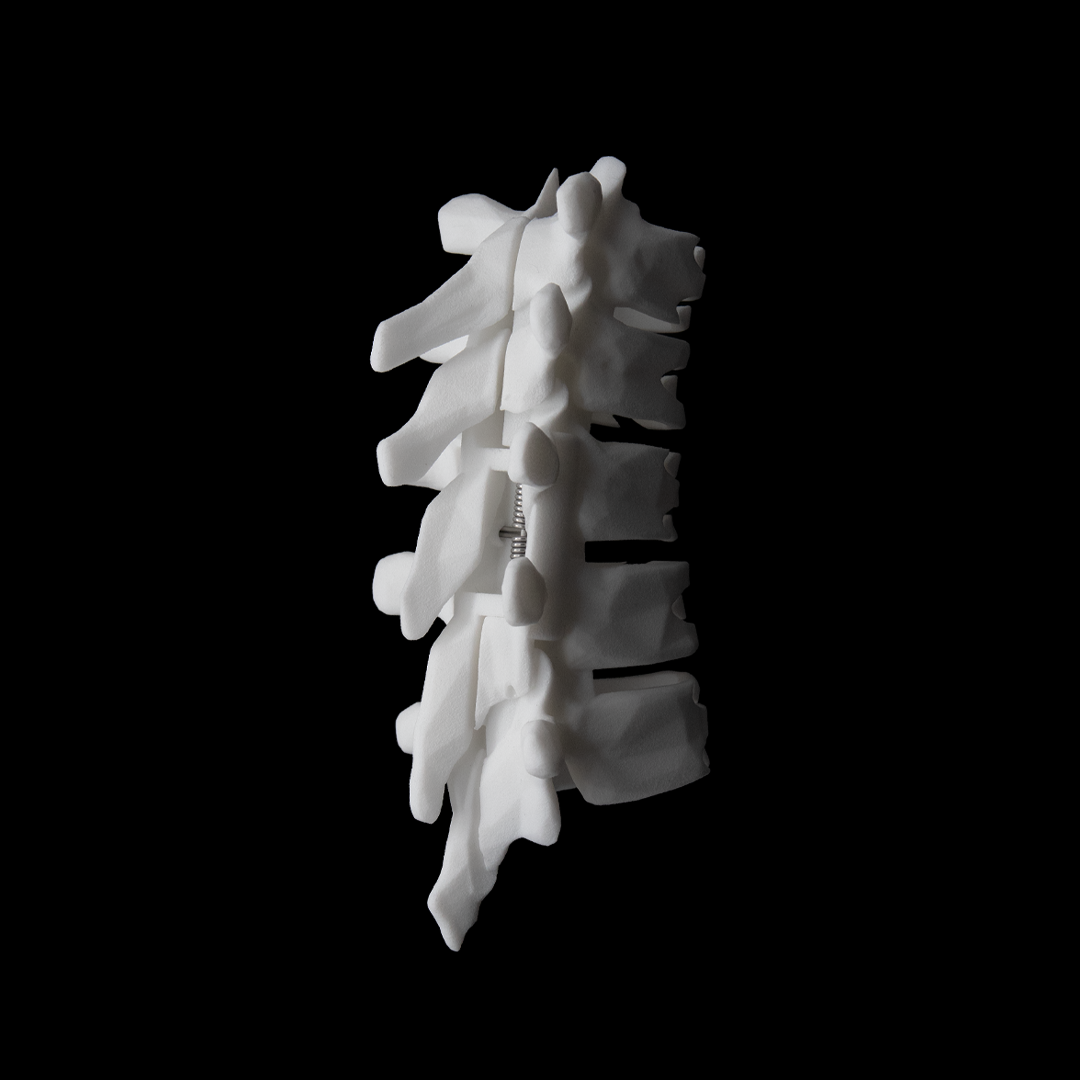 SHC-M / Bone
