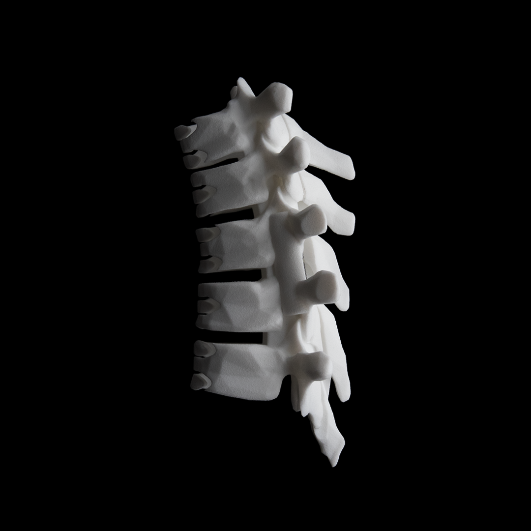 SHC-M / Bone