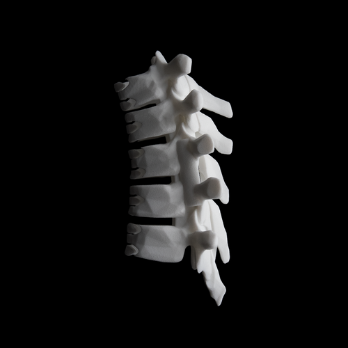 SHC-M / Bone